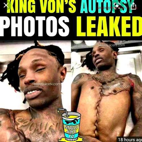 autopsy photo king von|King Von Autopsy Revealed .